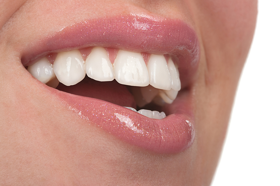 Transform Your Smile with Dental Veneers and Dental Laminates in Kilgore, TX: A Comprehensive Guide