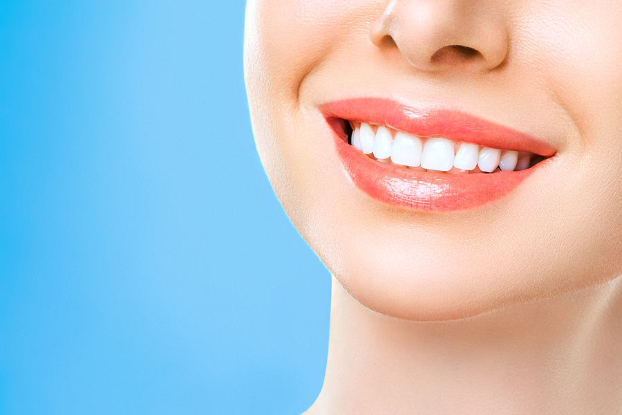 Brighten Your Smile: The Benefits of Opalescence Boost Teeth Whitening in Kilgore, TX